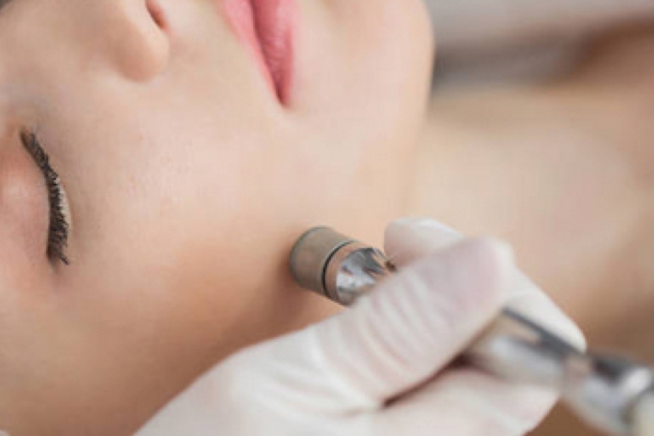 Microdermabrasion Stuttgart